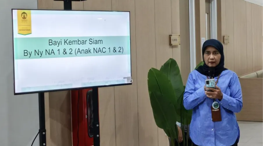 Operasi 36 Jam RSCM, Tonggak Baru Penanganan Kembar Siam