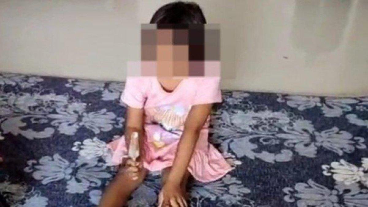 Akibat Dicolok Kakak Kelas Mata Siswi Kelas 2 SD di Gresik Buta Permanen