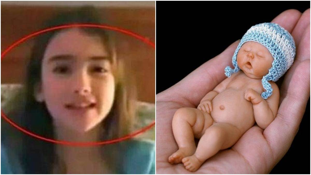 Amelia Taylor Bayi Terkecil di Dunia? Kini Tumbuh jadi Gadis Cantik