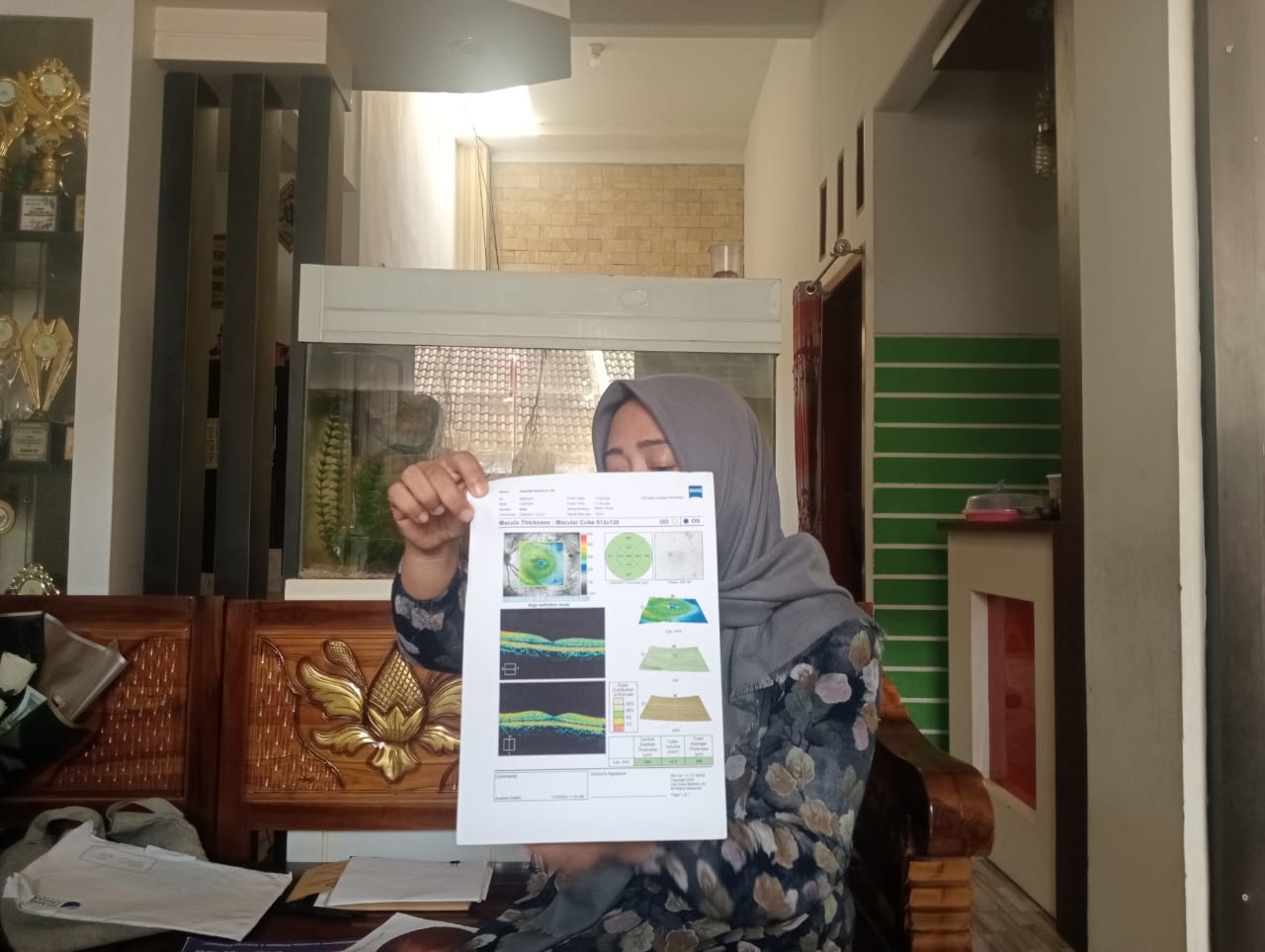 Terlempar Kayu saat di Sekolah Bocah SD di Jombang Terancam Buta Permanen